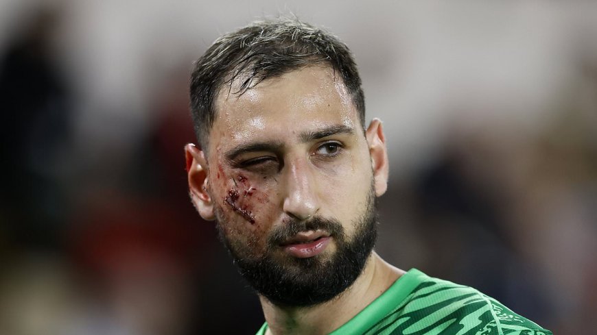 Gianluigi Donnarumma provides two-word update as PSG star shares new photo after suffering a serious facial injury against Monaco