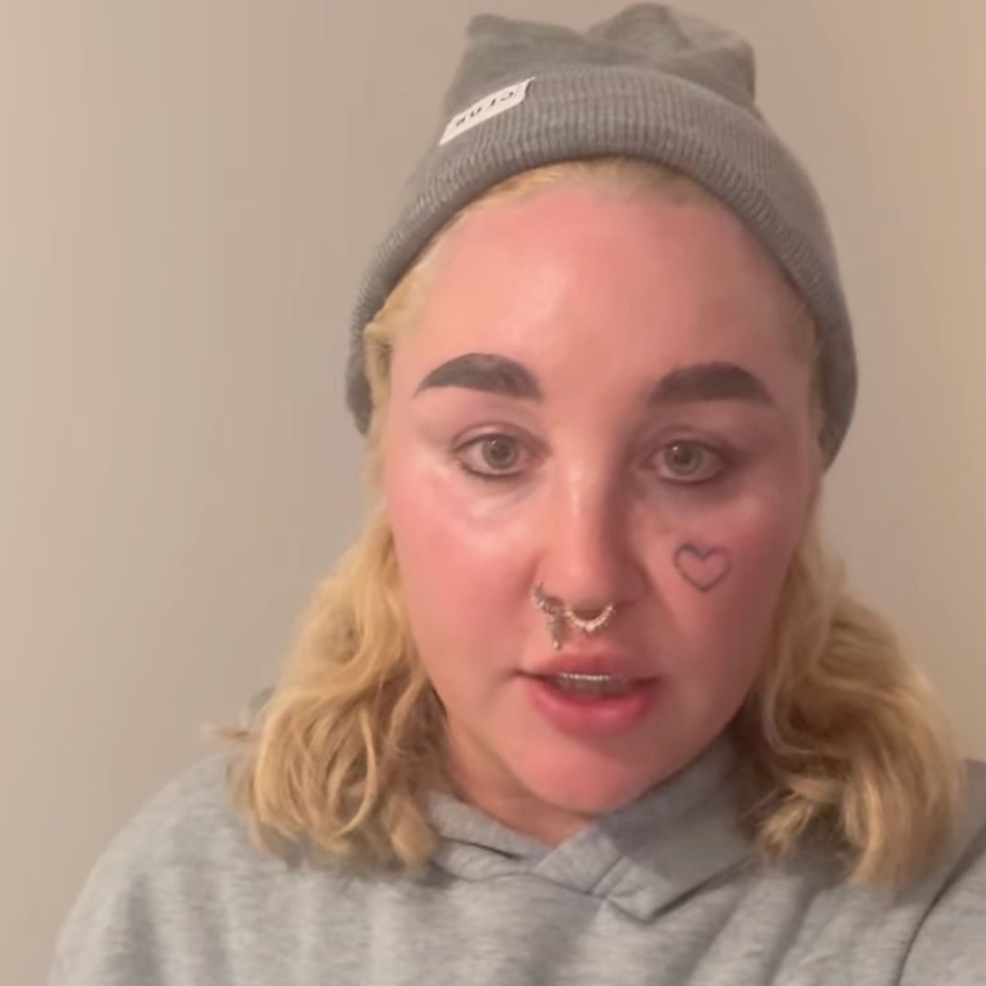 Amanda Bynes Explains Why She Cant Wear Tooth Gems