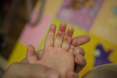 保母餵1歲半幼兒吃起司饅頭！塞「5碎塊」缺氧過久...搶救45天亡