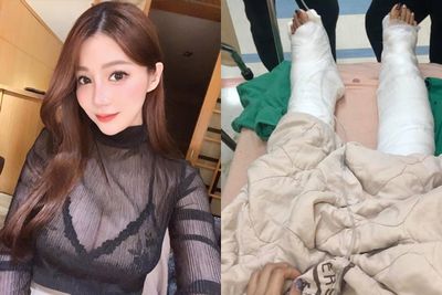 女網紅台東搭船遭「捲入螺旋槳」！美腿重傷留疤　船長挨告結果曝