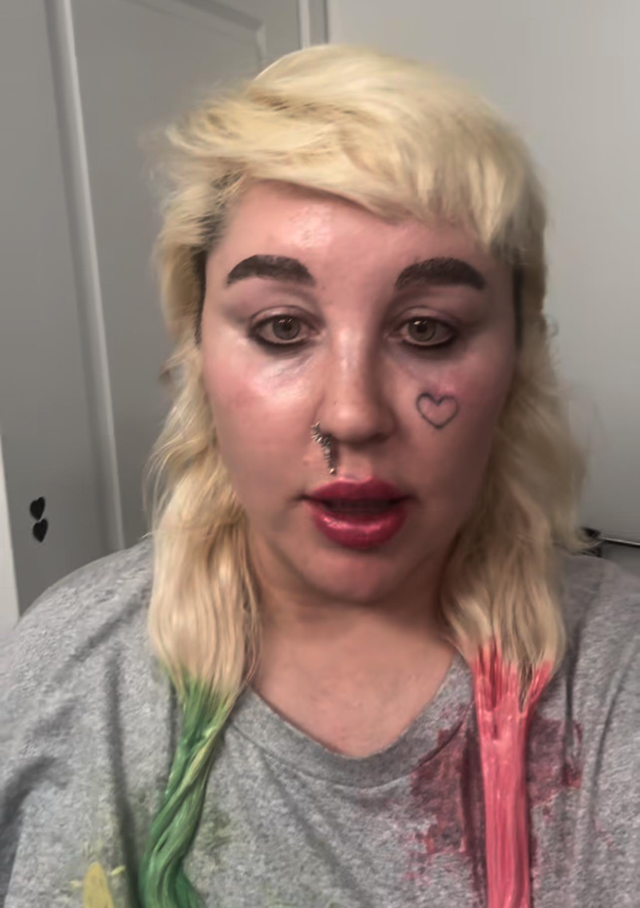 Amanda Bynes announces getting on Ozempic