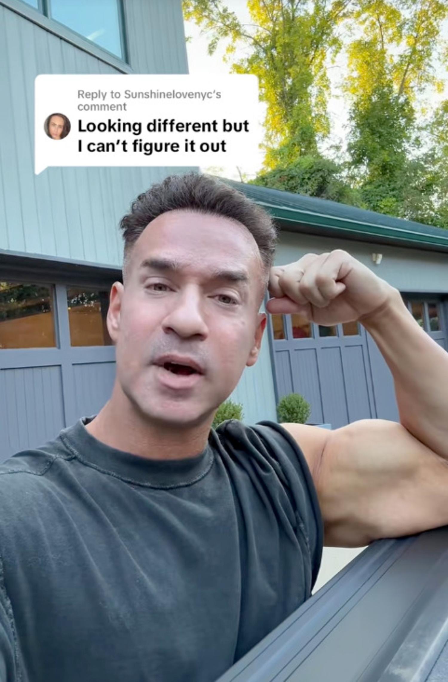 Mike "The Situation" responding to rumors he got a facelift. 