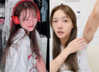 正妹YTR遭韓男暴打首露面！狼狽全身傷現狀曝光　公開當晚完整對話