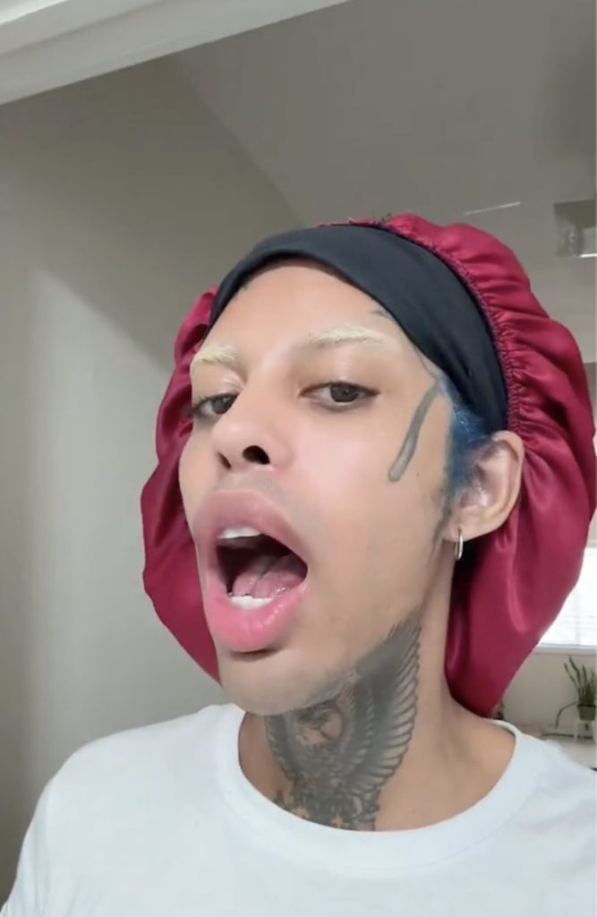 TikTok Star Alluringskull Shares Before and After Videos of Tongue-Splitting Cosmetic Procedure-1