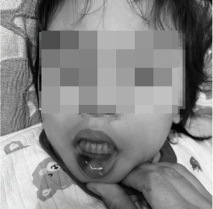 超扯！台東特教師狠虐6幼童「全身是瘀青」　校長調職加給照領