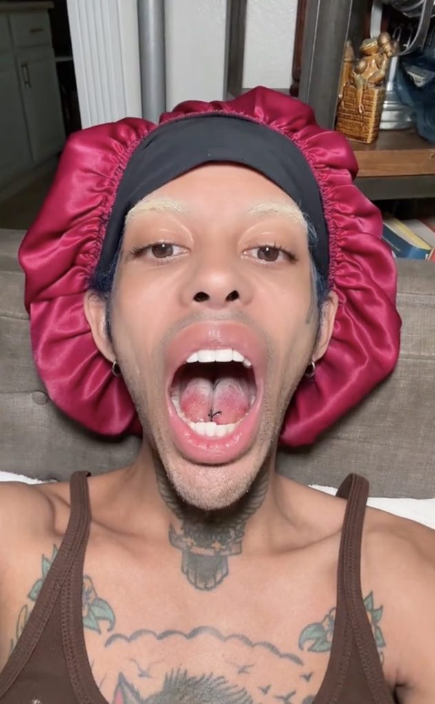 2-TikTok Star Alluringskull Shares Before and After Videos of Tongue-Splitting Cosmetic Procedure-2
