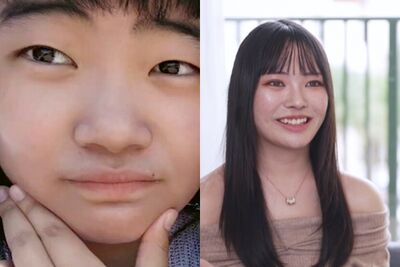 被前男友羞辱醜！21歲櫻花妹砸19萬整形重生　換臉對比照曝