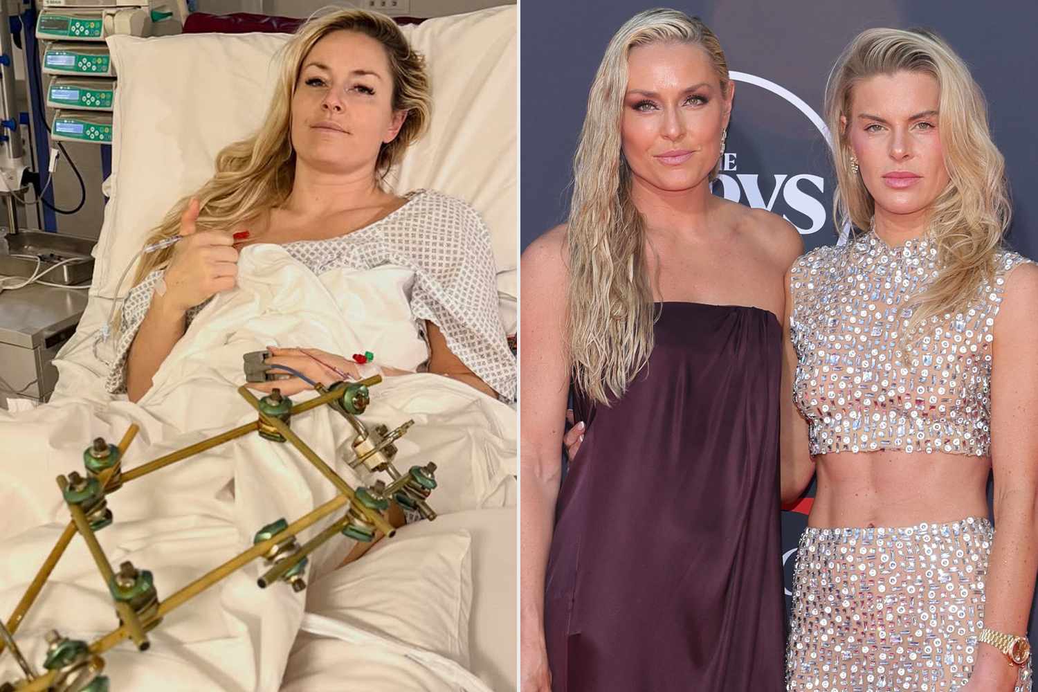 Lindsey Vonn after surgery; Lindsey Vonn and Karin Kildow Lindsey Vonn/Instagram; Maya Dehlin Spach/WireImage