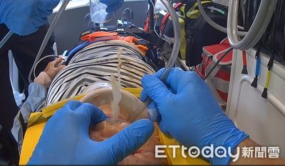 鐵工廠工人突昏厥倒地　屏東首支高級救護隊鬼門關前搶命