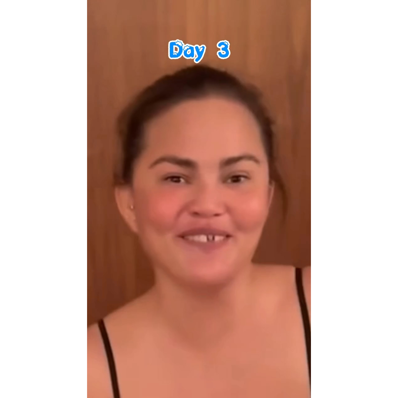 Chrissy Teigen Knocks Out Front Tooth in Candy Cane Accident