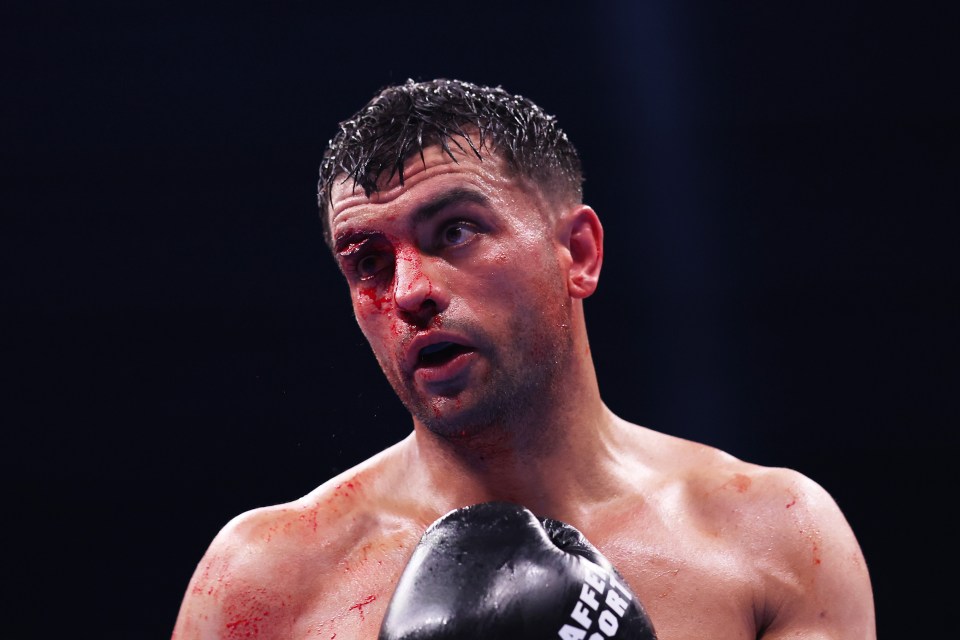 MANCHESTER, ENGLAND - JULY 05: Jack Catterall looks on with a cut to his right eye during his IBF Inter-Continental Welterweight title fight against Harlem Eubank on 'The Warrior Code' fight card at AO Arena on July 05, 2025 in Manchester, England. (Photo by Alex Livesey/Getty Images)