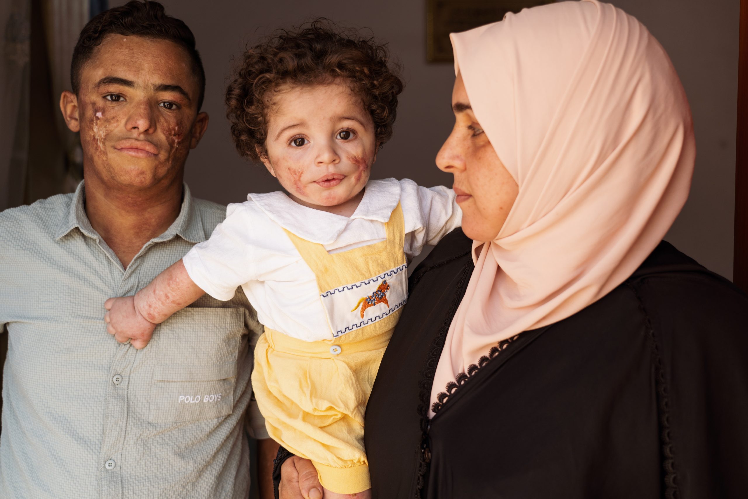 Iman holds her 11-month-old as her sons’ faces bear the marks of a severe skin disease—one of the many health conditions families in Fallujah link to the city’s toxic inheritance from the 2004 assaults. Photo by Jaclynn Ashly.