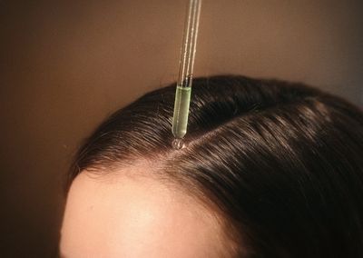 用錯等於白擦！養髮頭皮精華4個重點必看　這樣才有效